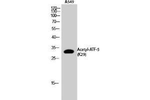 Western Blot (WB) analysis of A549 cells using Acetyl-ATF-5 (K29) Polyclonal Antibody. (ATF5 抗体  (acLys29))