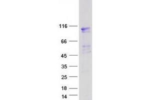 Western Blotting (WB) image for Ecotropic Viral Integration Site 5-Like (EVI5L) protein (Myc-DYKDDDDK Tag) (ABIN2720596)