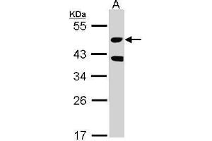 WB Image Sample (30 ug of whole cell lysate) A: Raji 10% SDS PAGE antibody diluted at 1:1000 (STK24 抗体)
