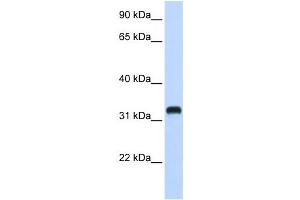 Western Blotting (WB) image for anti-Chromosome 21 Open Reading Frame 62 (C21orf62) antibody (ABIN2458967) (C21orf62 抗体)