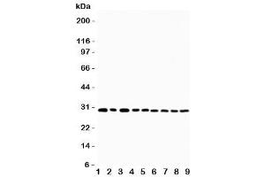 Western blot testing of OX40 antibody and Lane 1:  U87 (TNFRSF4 抗体  (N-Term))