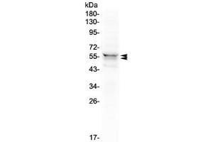 Western blot testing of human 293T cell lysate with LYN antibody at 0.