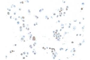 Immunocytochemistry (ICC) image for anti-Estrogen Receptor 1 (ESR1) antibody (ABIN7455134) (Estrogen Receptor alpha 抗体)