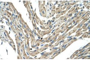 Human Muscle (FBXL5 抗体  (Middle Region))