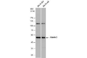 WB Image Ataxin 3 antibody detects Ataxin 3 protein by western blot analysis. (Ataxin 3 抗体)