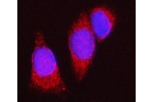 IF analysis of Spindly/SPDL1 using anti-Spindly/SPDL1 antibody (ABIN7601654). (CCDC99 抗体  (AA 40-605))