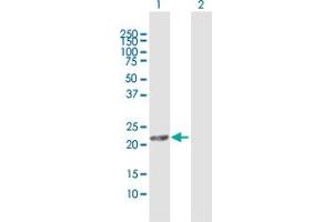 Western Blot analysis of MGC4172 expression in transfected 293T cell line by MGC4172 MaxPab polyclonal antibody. (DHRS11 抗体  (AA 1-181))