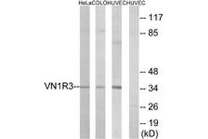 Western blot analysis of extracts from HuvEc/HeLa/COLO cells, using VN1R3 Antibody.