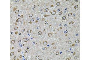 Immunohistochemistry of paraffin-embedded Rat brain using EIF4A2 Polyclonal Antibody at dilution of 1:100 (40x lens). (EIF4A2 抗体)