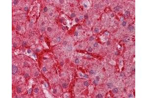 IHC testing of FFPE human liver tissue with Arginase 1 antibody at 3. (Liver Arginase 抗体)