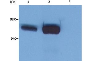 Western Blotting (WB) image for anti-Lymphocyte Cytosolic Protein 2 (SH2 Domain Containing Leukocyte Protein of 76kDa) (LCP2) (AA 216-434) antibody (ABIN94466)