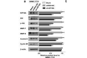 Western Blotting (WB) image for anti-Cyclin B1 (CCNB1) antibody (ABIN2854892)