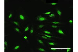 Immunofluorescence of purified MaxPab antibody to NEK3 on HeLa cell. (NEK3 抗体  (AA 1-506))