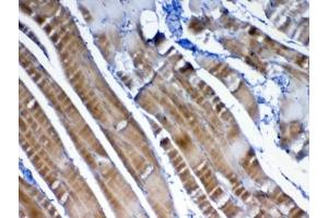IHC testing of FFPE rat skeletal muscle tissue with VEGFB antibody at 1ug/ml. (VEGFB (VEGF2) 抗体)