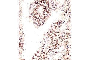 Immunohistochemical analysis of paraffin-embedded H. (H2AFX 抗体  (N-Term))
