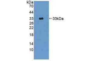 Western blot analysis of recombinant Rat OAS1. (OAS1 抗体  (AA 139-358))
