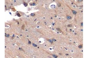Detection of SNUPN1 in Human Cerebrum Tissue using Polyclonal Antibody to Snurportin 1 (SNUPN1) (Snurportin 1 抗体  (AA 1-360))