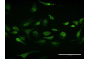 Immunofluorescence of purified MaxPab antibody to ELAVL1 on HeLa cell. (ELAVL1 抗体  (AA 1-326))