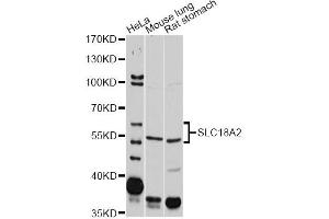 Western blot analysis of extracts of various cell lines, using SLC18A2 antibody (ABIN1874806) at 1:2000 dilution. (SLC18A2 抗体)