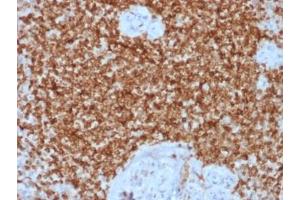 Immunohistochemistry (IHC) image for anti-B-Cell CLL/lymphoma 2 (BCL2) antibody (ABIN5707800)
