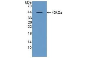 Detection of Recombinant TPP1, Mouse using Polyclonal Antibody to Tripeptidyl Peptidase I (TPP1) (TPP1 抗体  (AA 198-562))