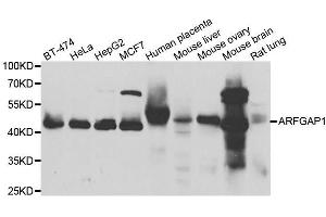 Western blot analysis of extracts of various cell lines, using ARFGAP1 antibody. (ARFGAP1 抗体  (AA 1-220))