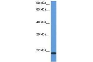 Image no. 1 for anti-CD70 Molecule (CD70) (AA 31-80) antibody (ABIN6747332) (CD70 抗体  (AA 31-80))