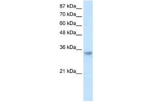 WB Suggested Anti-RNASEH2A Antibody Titration:  1. (RNASEH2A 抗体  (Middle Region))