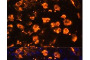 Immunofluorescence analysis of C6 cells using JAG2 Polyclonal Antibody at dilution of 1:100. (JAG2 抗体)