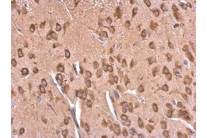 IHC-P Image EEF1A2 antibody detects EEF1A2 protein at cytosol on rat fore brain by immunohistochemical analysis. (EEF1A2 抗体)