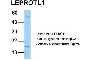 Host: Rabbit Target Name: LEPROTL1 Sample Type: Human HepG2 Antibody Dilution: 1. (LEPROTL1 抗体  (N-Term))