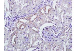 Paraformaldehyde-fixed, paraffin embedded rat kidney tissue, Antigen retrieval by boiling in sodium citrate buffer(pH6) for 15min, Block endogenous peroxidase by 3% hydrogen peroxide for 30 minutes, Blocking buffer (normal goat serum) at 37°C for 20min, Antibody incubation with Rabbit Anti-PERK Polyclonal Antibody, Unconjugated  at 1:500 overnight at 4°C, followed by a conjugated secondary and DAB staining (PERK 抗体  (AA 1001-1116))