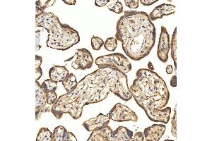 IHC analysis of Citrin/SLC25A13 using anti-Citrin/SLC25A13 antibody (ABIN7599512). (slc25a13 抗体  (AA 1-643))