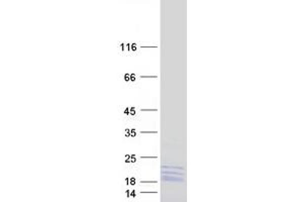 RPL14 Protein (Transcript Variant 1) (Myc-DYKDDDDK Tag)