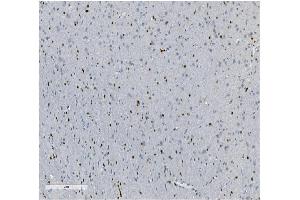 IHC analysis of Transketolase/TKT using anti-Transketolase/TKT antibody (ABIN7598959).