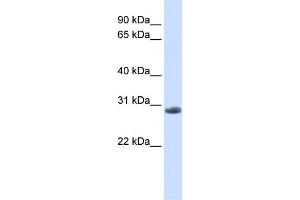 WB Suggested Anti-YIPF6 Antibody Titration:  0. (YIPF6 抗体  (C-Term))