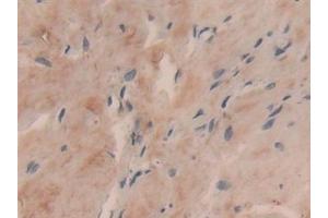 Immunohistochemistry (IHC) image for anti-Collagen, Type VI, alpha 3 (COL6a3) (AA 463-624) antibody (ABIN7434719)