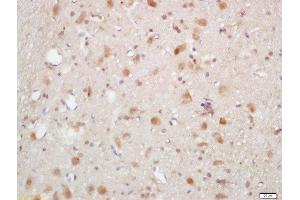 Formalin-fixed and paraffin embedded rat brain labeled with Rabbit Anti-AKT1/2/3 (Thr305/308/309) Polyclonal Antibody, Unconjugated (ABIN756052) at 1:200 followed by conjugation to the secondary antibody and DAB staining (AKT 1/2/3 抗体  (pThr305, pThr308, pThr309))