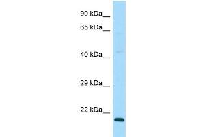 WB Suggested Anti-DAND5 Antibody Titration: 1. (DAND5 抗体  (C-Term))