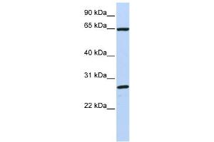 DNAJC1 antibody used at 1 ug/ml to detect target protein. (DNAJC1 抗体)