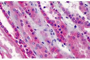 Human Kidney: Formalin-Fixed, Paraffin-Embedded (FFPE) (TRAF5 抗体  (AA 77-186))