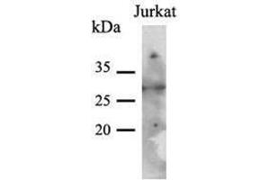 Image no. 1 for anti-Phenylethanolamine N-Methyltransferase (PNMT) (AA 1-282), (N-Term) antibody (ABIN954226) (PNMT 抗体  (N-Term))