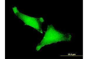Immunofluorescence of monoclonal antibody to ZNF175 on HeLa cell. (ZNF175 抗体  (AA 81-178))