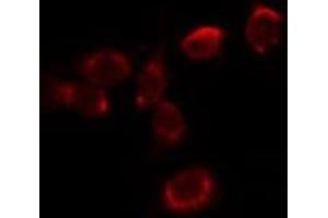 ABIN6278025 staining HepG2 by IF/ICC. (Hemoglobin Alpha 1 + 2 (HBA1,HBA2) (Internal Region) 抗体)