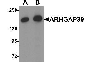 Western blot analysis of ARHGAP39 in A20 cell lysate with ARHGAP39 antibody at (A) 1 and (B) 2 µg/mL (ARHGAP39 抗体  (C-Term))