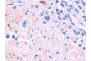Immunohistochemistry (IHC) image for anti-Lecithin-Cholesterol Acyltransferase (LCAT) (AA 290-433) antibody (ABIN7436690)