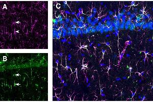 Expression of GFAP and TSH Receptor in rat hippocampus CA1 region. (GFAP 抗体  (Intracellular) (Atto 647N))