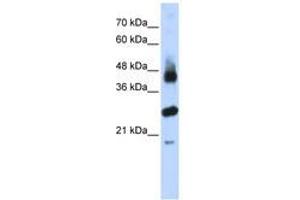 Image no. 1 for anti-F-Box and Leucine-Rich Repeat Protein 2 (FBXL2) (AA 71-120) antibody (ABIN6740795) (FBXL2 抗体  (AA 71-120))
