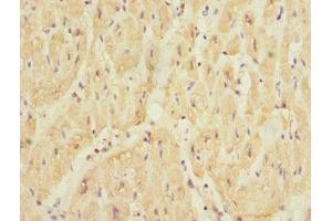 Immunohistochemistry of paraffin-embedded human heart tissue using ABIN7169860 at dilution of 1:100