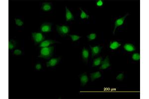 Immunofluorescence of monoclonal antibody to PDE6D on HeLa cell. (PDE6D 抗体  (AA 1-150))